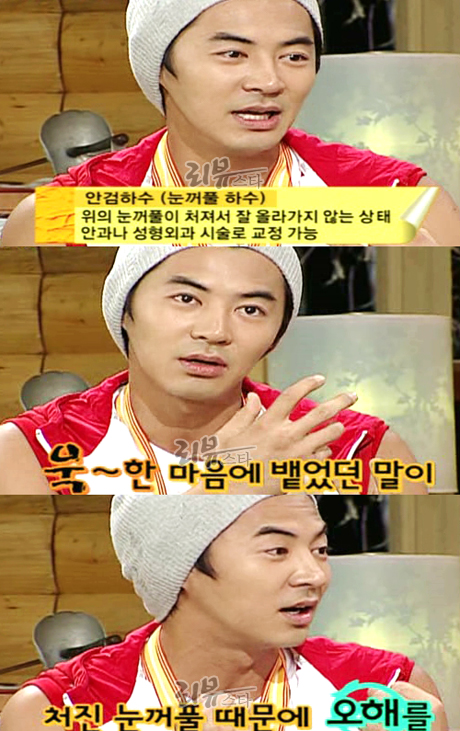 전진, 성형파문 솔직 고백 “쌍꺼풀 아니라 안검하수 수술”