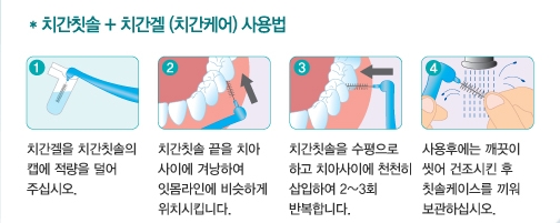 치과보다 쉬운 구강관리 이젠 [덴터시스템 4]으로 관리하세요/딥클린 ...